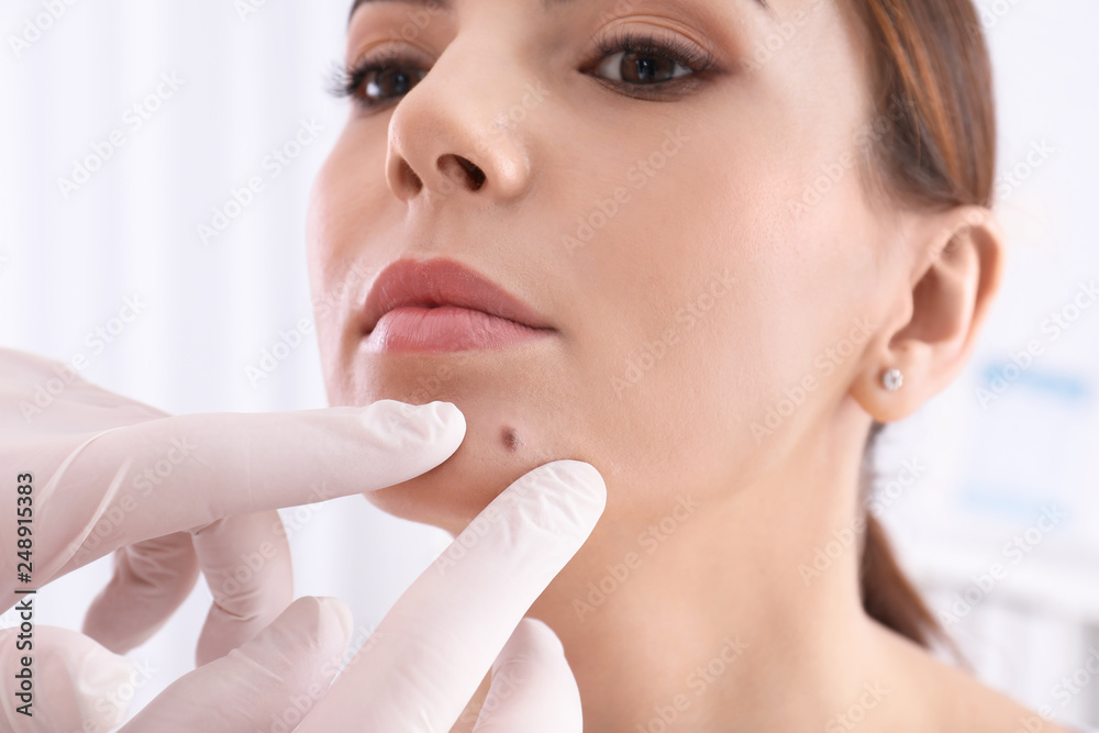 Dermatologist examining patient in clinic, closeup view Dermatologist examining patient in clinic, closeup view