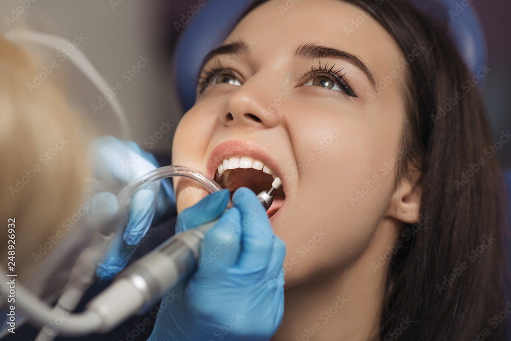 Dentist polishing patient teeth at the dental office. Dentist polishing patient teeth at the dental office.