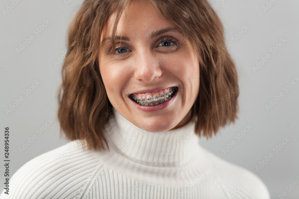 Young beautiful woman with braces Young beautiful woman with braces