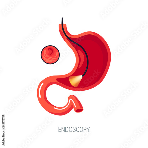 Endoscopy diagnostic, vector concept in flat style