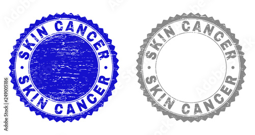 Grunge SKIN CANCER stamp seals isolated on a white background. Rosette seals with grunge texture in blue and gray colors. Vector rubber stamp imitation of SKIN CANCER tag inside round rosette.