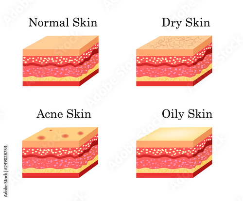 Skin types icons set. Vector stock illustration