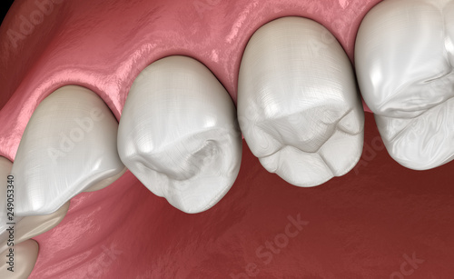 Maxillary human gum and teeth. Medically accurate tooth 3D illustration photo
