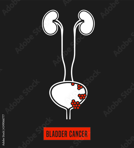 Bladder Cancer Icon