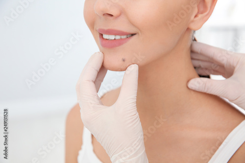 Dermatologist examining patient s birthmark in clinic  closeup