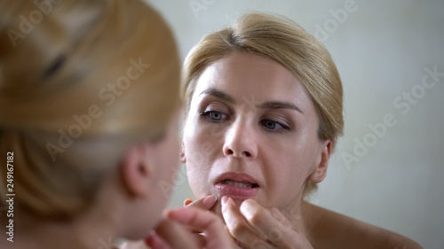 Pretty woman squeezing pimple on chin  hormonal disorder  health problems
