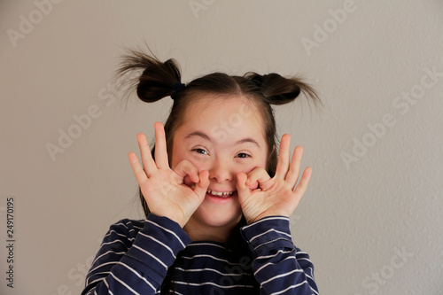 Cuadro en lienzo Cute smiling down syndrome girl on the grey background