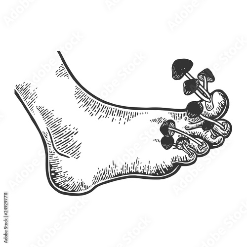 Nail fungus disease mushrooms metaphor engraving vector illustration. Scratch board style imitation. Black and white hand drawn image.