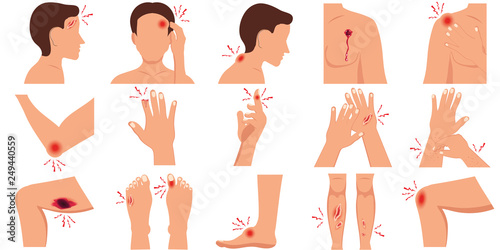 Pain in the human body parts physical injury flat set.