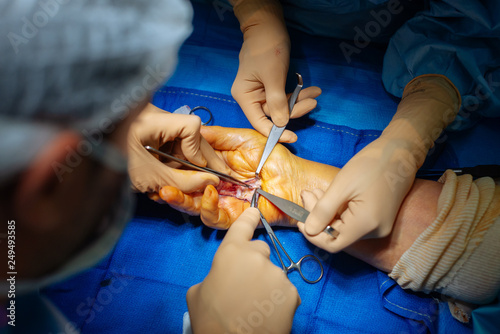 Surgeons performing hand surgery in hospital photo