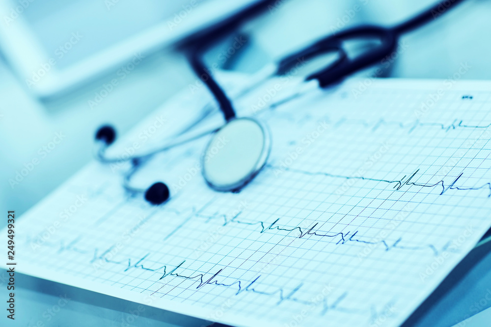 stethoscope and electrocardiogram on the table from the therapist stethoscope and electrocardiogram on the table from the therapist