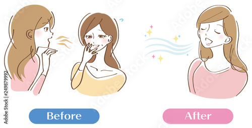 口臭くさい　女性　イラスト　セット