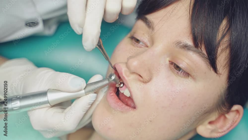 Stomatologist in white gloves cleaning the teeth of a woman in dental cabinet. Female's teeth and special dental tool-brush in work. Close-up Stomatologist in white gloves cleaning the teeth of a woman in dental cabinet. Female's teeth and special dental tool-brush in work. Close-up