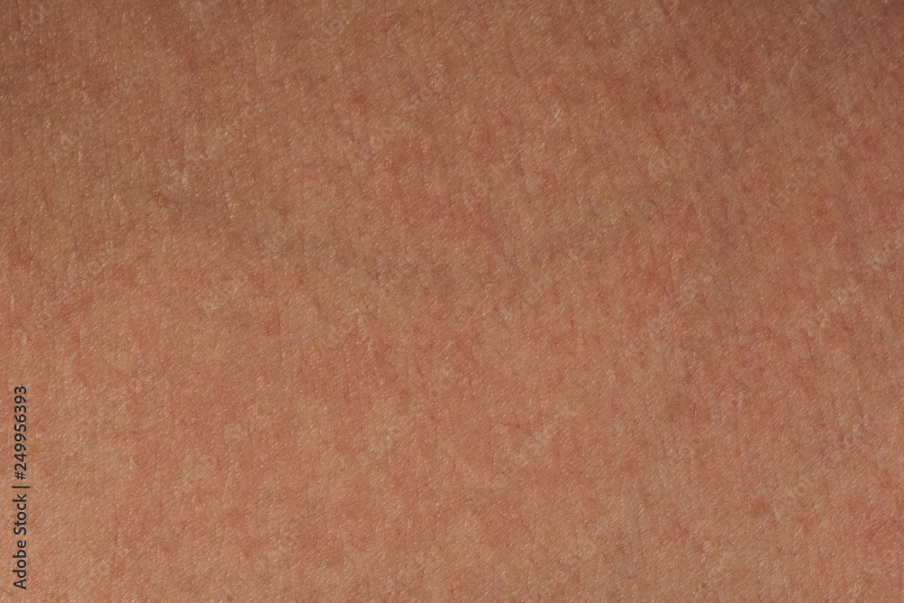 Flat skin pattern Flat skin pattern