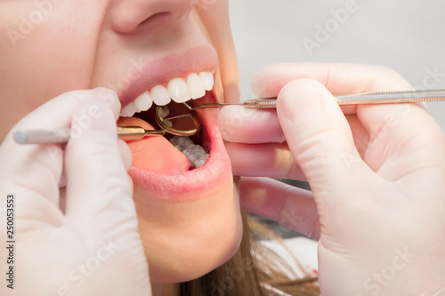 Adult young woman visiting dental office. Open mouth. Dentist hands in rubber protective gloves working with tools for patient's teeth. Closeup. Side view.  photo