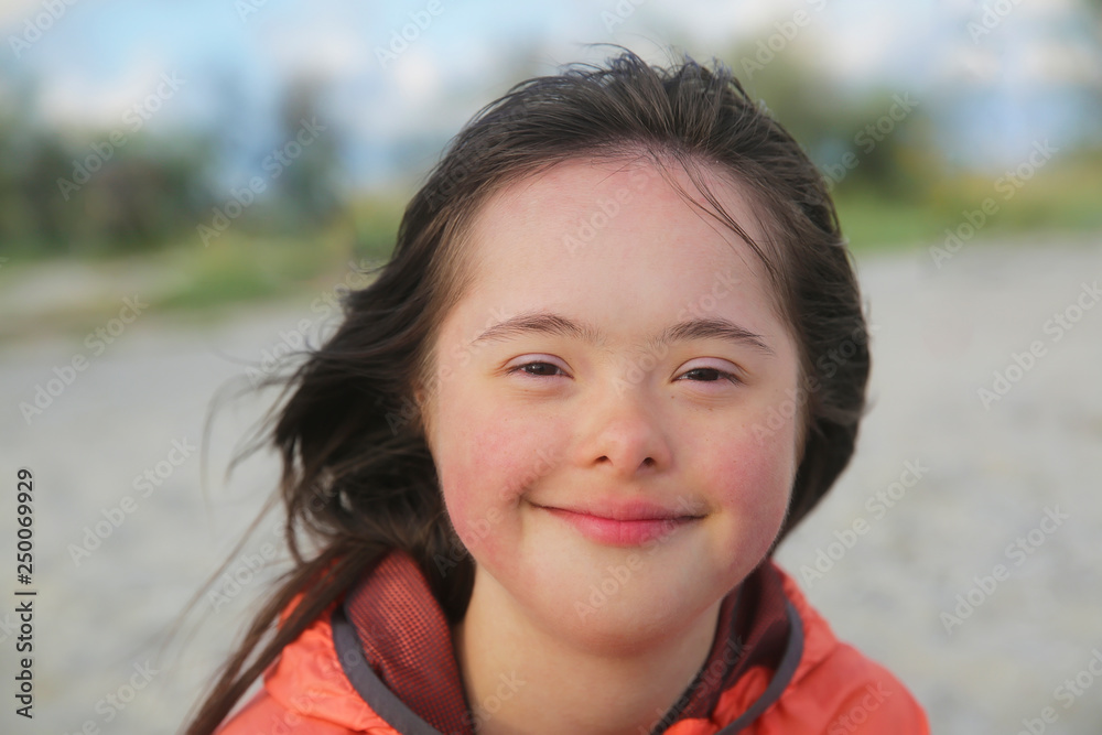 Portrait of down syndrome girl smiling Portrait of down syndrome girl smiling