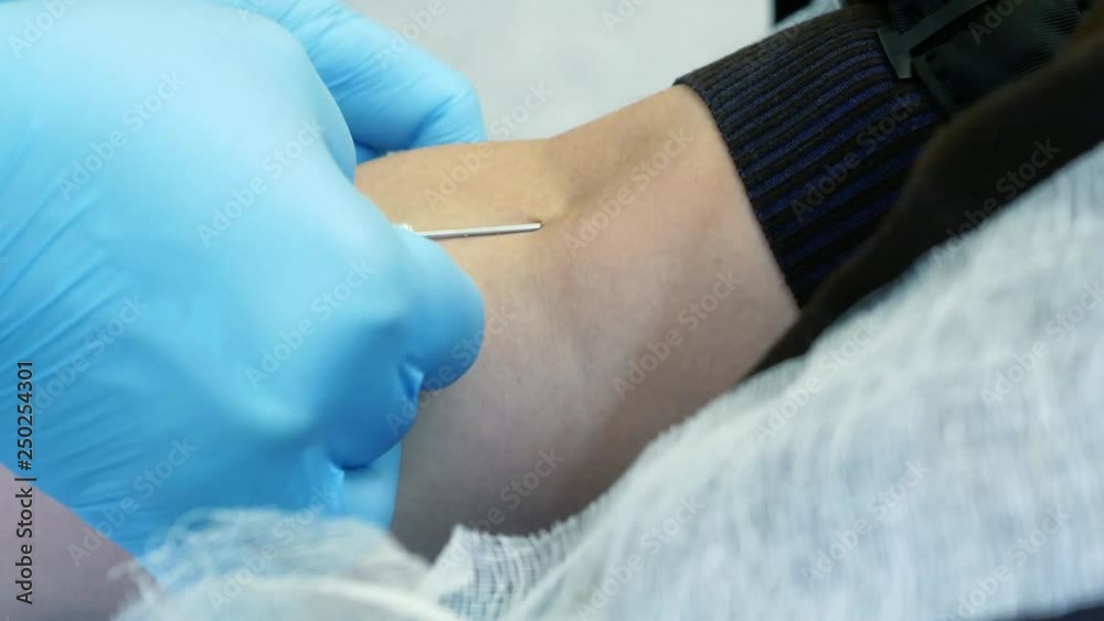 Donor giving blood, nurse stabs the needle in donors vein. Blood donation concept Donor giving blood, nurse stabs the needle in donors vein. Blood donation concept