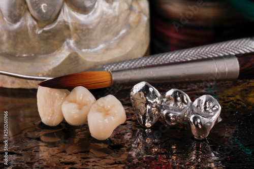 E-max pressed ceramic bridge and metal crown with dentistry utensils and mockup