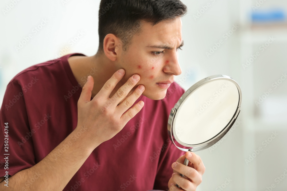 Portrait of young man with acne problem looking in mirror at home Portrait of young man with acne problem looking in mirror at home