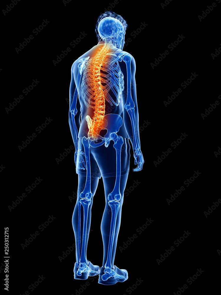 3d rendered medically accurate illustration of a man having back pain 3d rendered medically accurate illustration of a man having back pain