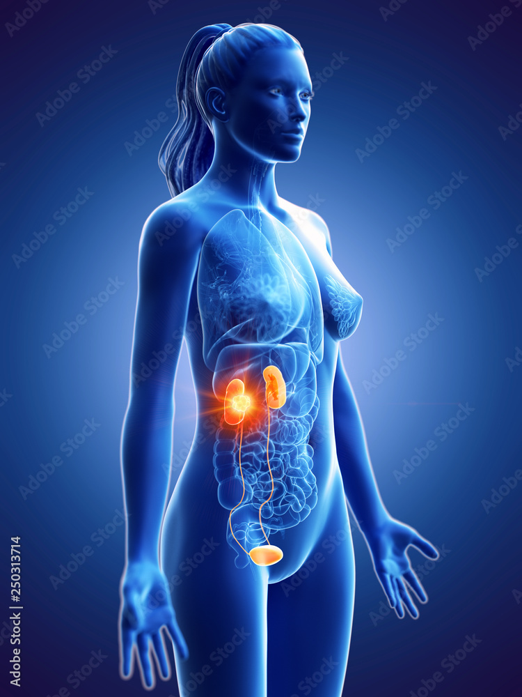 3d rendered medically accurate illustration of a womans kidney cancer 3d rendered medically accurate illustration of a womans kidney cancer