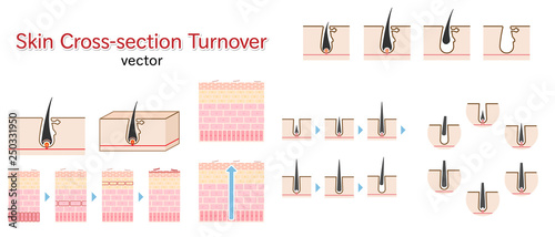 skin cross-section turnover illustration set