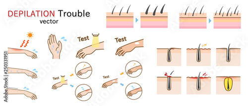 depilation trouble vector illustration set