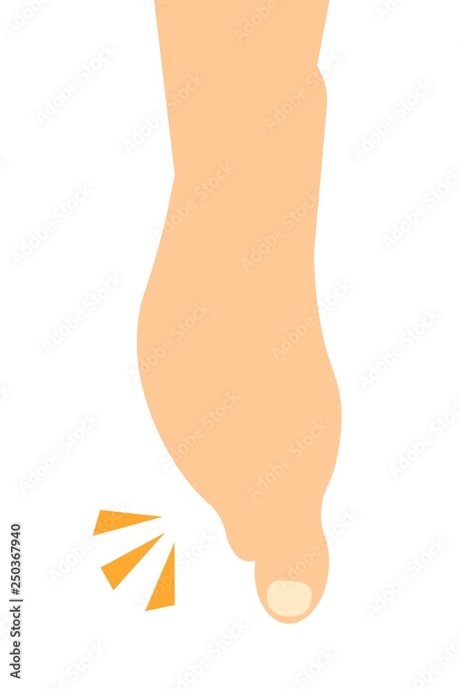 纏足(てんそく) 纏足(てんそく)