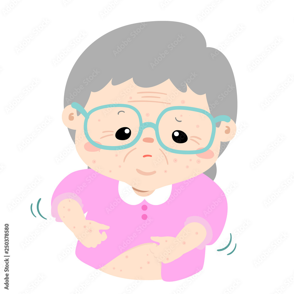 Grandmother scratching itching rash on her body vector Grandmother scratching itching rash on her body vector