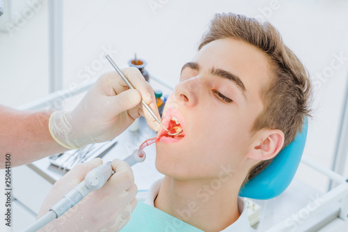 Dental caries prevention.Teenage boy at the dentist's chair during a dental procedure, smile close up. Healthy Smile.