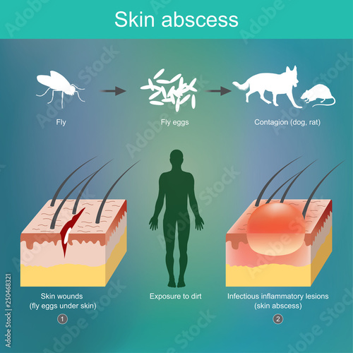 Inflammation of the skin resulting from pathogens entering open skin wounds.