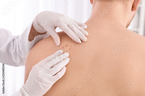 Dermatologist examining patient in clinic, closeup view