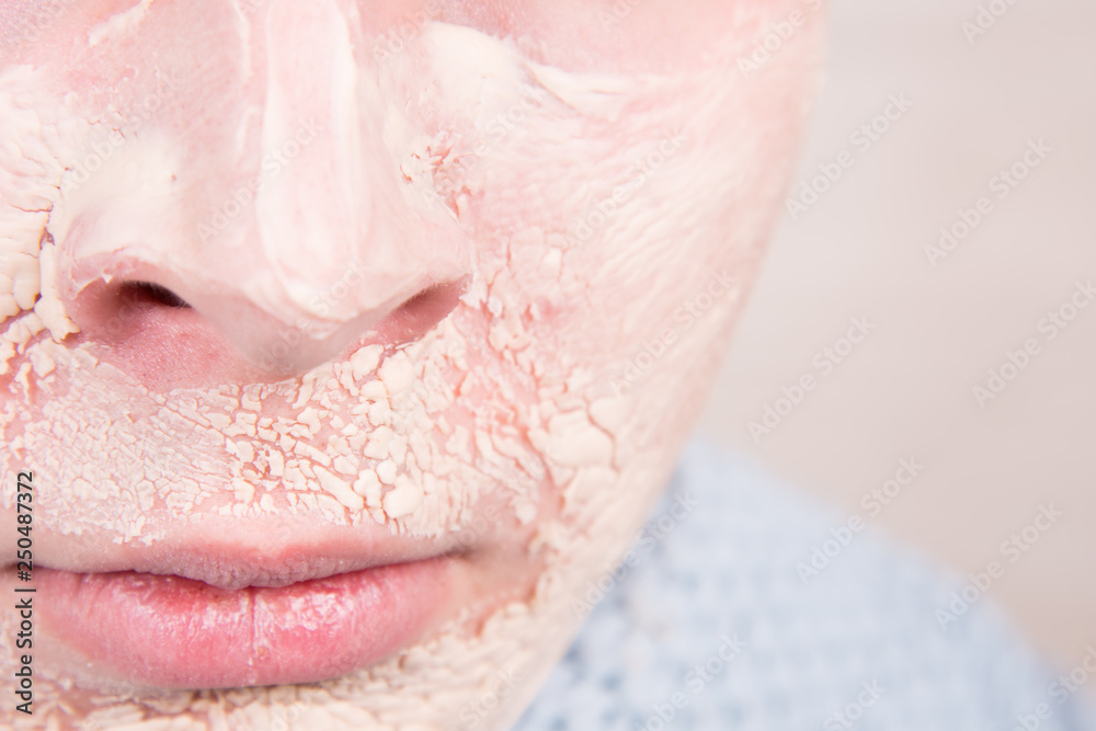 Obraz premium Male beauty. Acne. Skin problems.