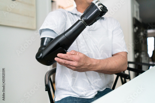 Man changes battery for his robotic arm