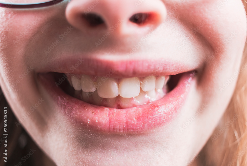 smile of a girl with white teeth smile of a girl with white teeth