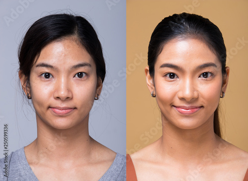 Asian Woman before applying make up hair style. no retouch, fresh face with acne, lips, eyes, cheek, nice smooth skin. Studio lighting white background, for aesthetics therapy treatment