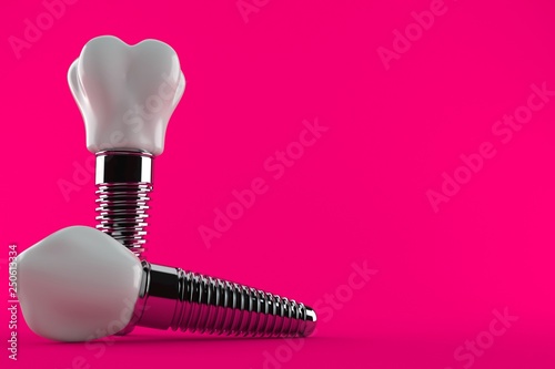 Dental implant photo