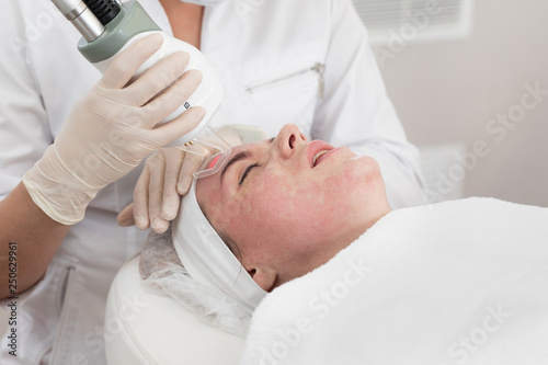 Face beauty treatment. Close-up of woman getting facial laser polishing and rejuvenation face procedure, cosmetologist using hardware apparatus