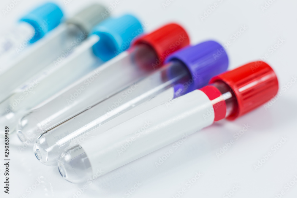 Bottles for samples used in hospitals or medicine for blood samples in a laboratory on white background