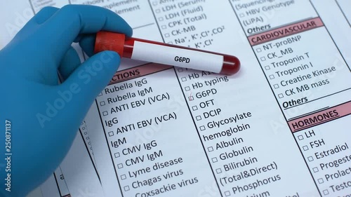 G6PD, doctor checking name in lab blank, showing blood sample in tube photo