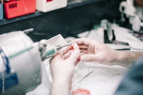 Dental Lab - Making a Denture