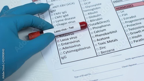 Lassa virus, doctor checking disease in lab blank, showing blood sample in tube photo