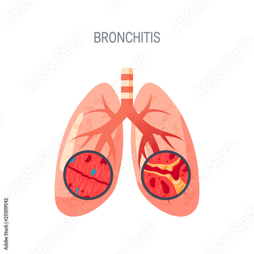 Bronchitis disease vector icon in flat style