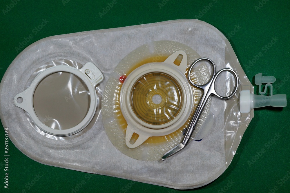 Urostomy - Ostomy medical care equipmen: Two-piece urostomy bag with ...
