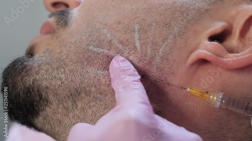 cosmetic injections for men