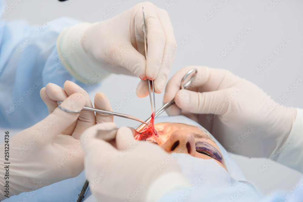 Blepharoplasty, plastic surgery operation for correcting defects, deformities, and disfigurations of the eyelids, and for aesthetically modifying the eye region of the face. in medical clinic Blepharoplasty, plastic surgery operation for correcting defects, deformities, and disfigurations of the eyelids, and for aesthetically modifying the eye region of the face. in medical clinic