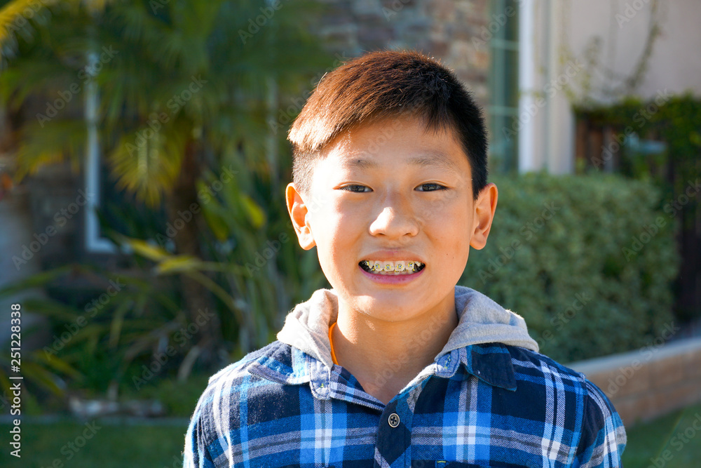 Portrait of young Asian boy with tooth braces. Young teen boy smiling and showing his orthodontic braces on his teeth. Portrait of young Asian boy with tooth braces. Young teen boy smiling and showing his orthodontic braces on his teeth.