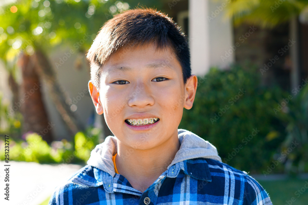 Portrait of young Asian boy with tooth braces. Young teen boy smiling and showing his orthodontic braces on his teeth. Portrait of young Asian boy with tooth braces. Young teen boy smiling and showing his orthodontic braces on his teeth.