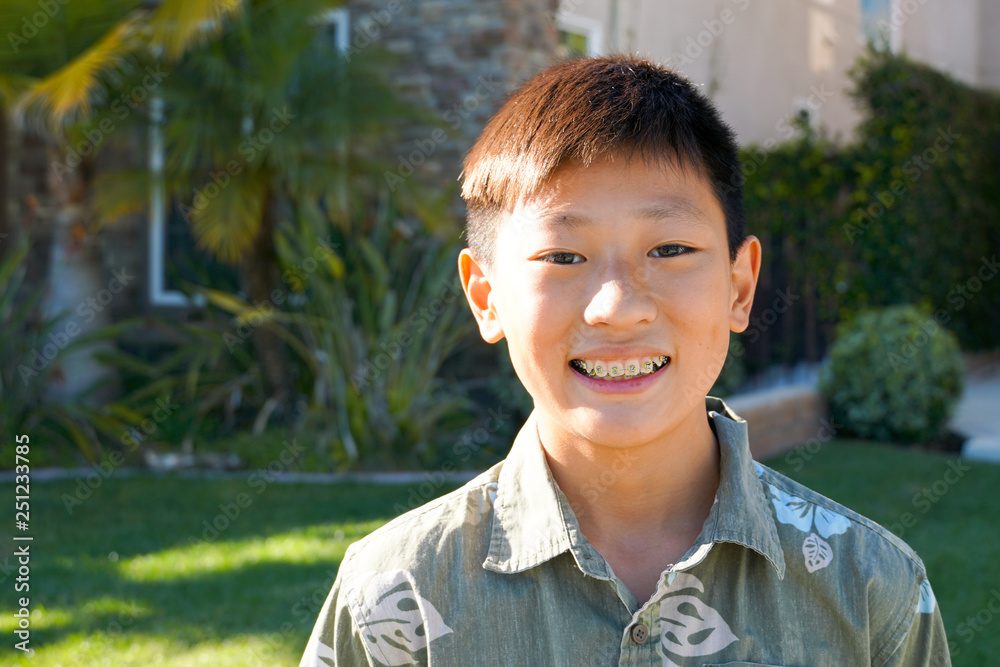 Portrait of young Asian boy with tooth braces. Young teen boy smiling and showing his orthodontic braces on his teeth. Portrait of young Asian boy with tooth braces. Young teen boy smiling and showing his orthodontic braces on his teeth.