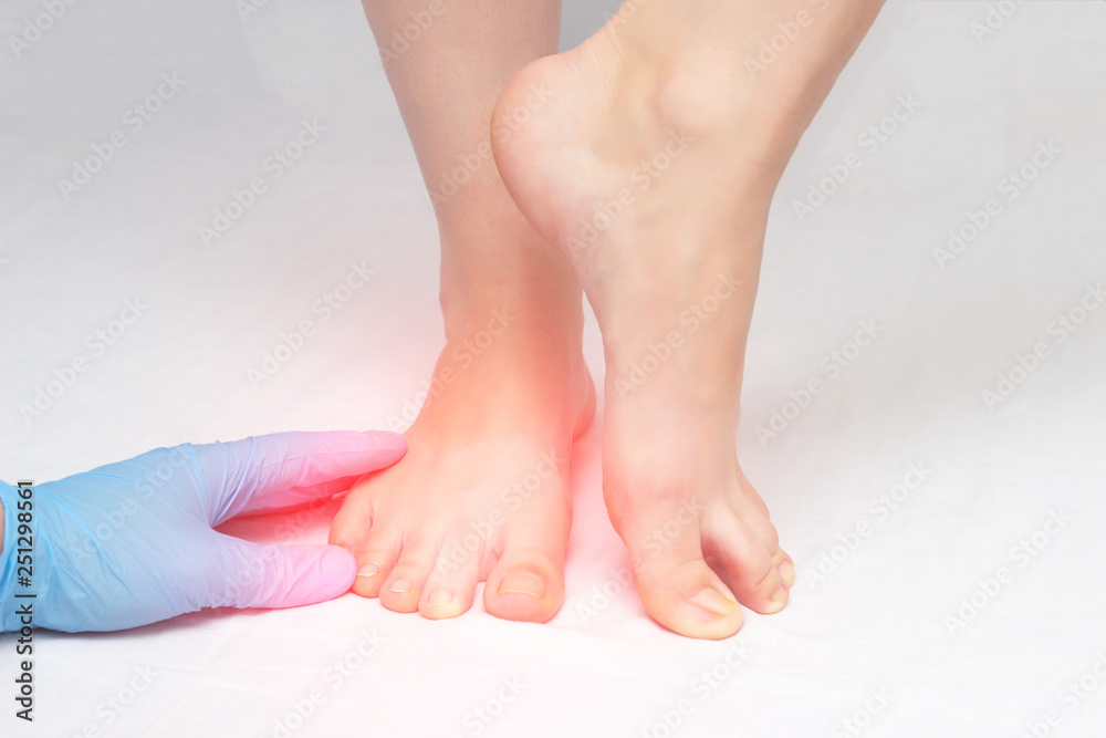 Doctor examines the patient's feet for the presence of fungus and cracks on the heels, white background, close-up, medicinal Doctor examines the patient's feet for the presence of fungus and cracks on the heels, white background, close-up, medicinal